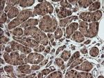 RhoJ Antibody in Immunohistochemistry (Paraffin) (IHC (P))