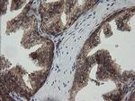 RhoJ Antibody in Immunohistochemistry (Paraffin) (IHC (P))