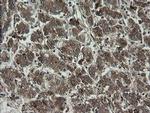 RhoJ Antibody in Immunohistochemistry (Paraffin) (IHC (P))