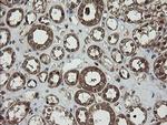 RhoJ Antibody in Immunohistochemistry (Paraffin) (IHC (P))