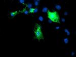 DIXDC1 Antibody in Immunocytochemistry (ICC/IF)