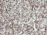 CDC123 Antibody in Immunohistochemistry (Paraffin) (IHC (P))