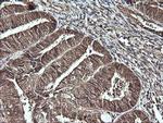 CDC123 Antibody in Immunohistochemistry (Paraffin) (IHC (P))