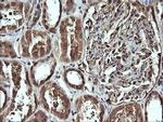 CDC123 Antibody in Immunohistochemistry (Paraffin) (IHC (P))