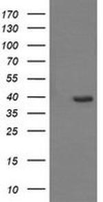 CDC123 Antibody in Western Blot (WB)