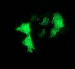 MYBPH Antibody in Immunocytochemistry (ICC/IF)