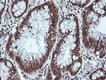 MYBPH Antibody in Immunohistochemistry (Paraffin) (IHC (P))