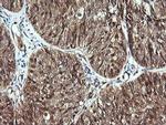 CDC123 Antibody in Immunohistochemistry (Paraffin) (IHC (P))