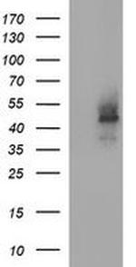 CDC123 Antibody in Western Blot (WB)