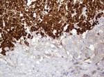 PARVB Antibody in Immunohistochemistry (Paraffin) (IHC (P))