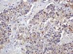 PARVB Antibody in Immunohistochemistry (Paraffin) (IHC (P))