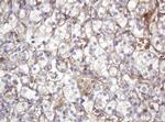 ARPC5 Antibody in Immunohistochemistry (Paraffin) (IHC (P))