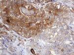 ARPC5 Antibody in Immunohistochemistry (Paraffin) (IHC (P))