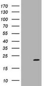 ARPC5 Antibody in Western Blot (WB)