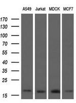 ARPC5 Antibody in Western Blot (WB)