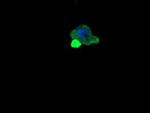 MDMX Antibody in Immunocytochemistry (ICC/IF)