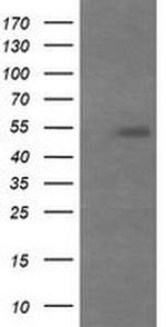 MDMX Antibody in Western Blot (WB)