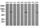 MDMX Antibody in Western Blot (WB)