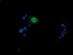 MDMX Antibody in Immunocytochemistry (ICC/IF)