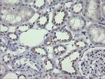 MDMX Antibody in Immunohistochemistry (Paraffin) (IHC (P))