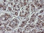 MDMX Antibody in Immunohistochemistry (Paraffin) (IHC (P))