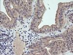 RAB21 Antibody in Immunohistochemistry (Paraffin) (IHC (P))