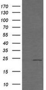 RAB21 Antibody in Western Blot (WB)