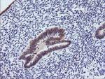 PIK3R5 Antibody in Immunohistochemistry (Paraffin) (IHC (P))