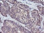 PIK3R5 Antibody in Immunohistochemistry (Paraffin) (IHC (P))