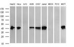 THUMPD1 Antibody in Western Blot (WB)