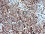 RALB Antibody in Immunohistochemistry (Paraffin) (IHC (P))