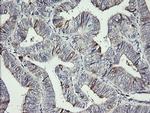 DPCD Antibody in Immunohistochemistry (Paraffin) (IHC (P))