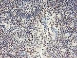 SESTD1 Antibody in Immunohistochemistry (Paraffin) (IHC (P))