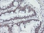 SESTD1 Antibody in Immunohistochemistry (Paraffin) (IHC (P))