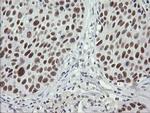 SESTD1 Antibody in Immunohistochemistry (Paraffin) (IHC (P))