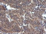 TRIM38 Antibody in Immunohistochemistry (Paraffin) (IHC (P))