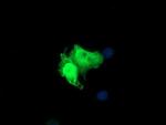 PARVA Antibody in Immunocytochemistry (ICC/IF)