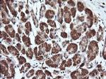 PARVA Antibody in Immunohistochemistry (Paraffin) (IHC (P))