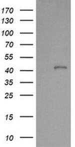 PARVA Antibody in Western Blot (WB)