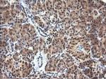 PARVA Antibody in Immunohistochemistry (Paraffin) (IHC (P))