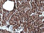 PIK3C2B Antibody in Immunohistochemistry (Paraffin) (IHC (P))