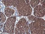 PIK3C2B Antibody in Immunohistochemistry (Paraffin) (IHC (P))