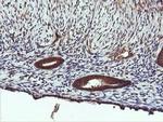 PIK3C2B Antibody in Immunohistochemistry (Paraffin) (IHC (P))