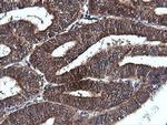 PIK3C2B Antibody in Immunohistochemistry (Paraffin) (IHC (P))