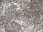 SAE1 Antibody in Immunohistochemistry (Paraffin) (IHC (P))