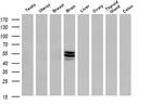 ERG Antibody in Western Blot (WB)