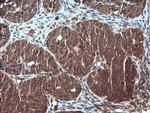 DNM1L Antibody in Immunohistochemistry (Paraffin) (IHC (P))