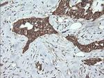 DNM1L Antibody in Immunohistochemistry (Paraffin) (IHC (P))