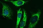 ACAA2 Antibody in Immunocytochemistry (ICC/IF)