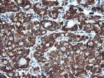 ACAA2 Antibody in Immunohistochemistry (Paraffin) (IHC (P))